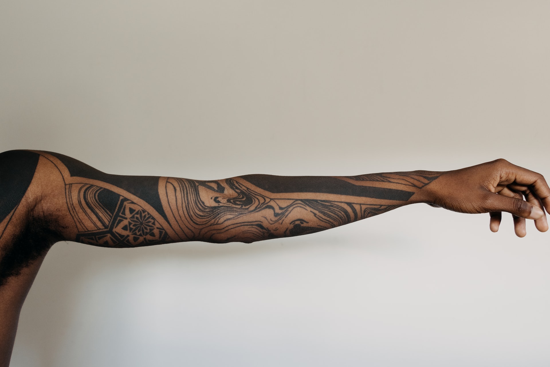 Tattooentfernung – Was ist es genau?